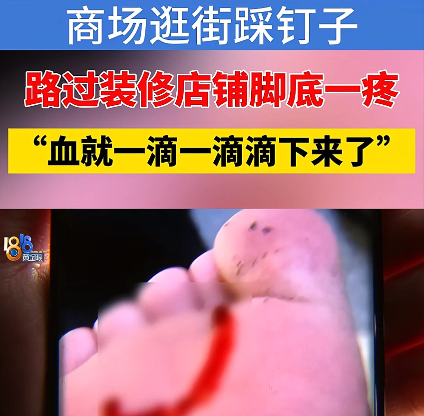 浙江杭州，一女子逛街时路过一装修商铺，岂料，不小心被钉子扎伤了脚，为此，女子花了