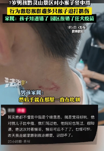 贵州，一个7岁小男孩对猴子竖中指！不料猴子二话不说纠集猴群对男孩又是抓又是挠
