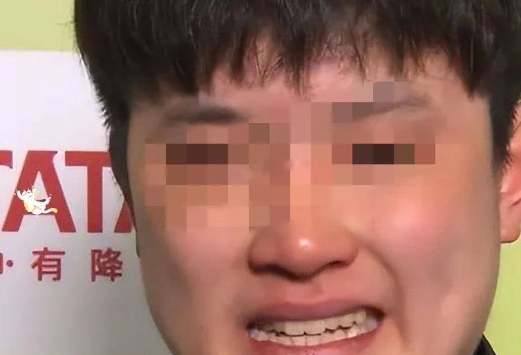 大冷门爆出！
那个不知天高地厚的张本智和被世界排名第十七的韩国一个很不看好的救