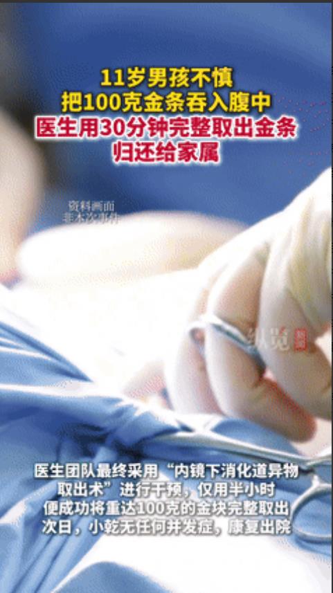 “真要命！”江苏一11岁男孩因为贪玩将100克金条吞下，送往医院后2天也没能排出