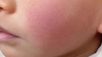 秋冬宝宝护肤别踩雷！4个常见误区揭秘