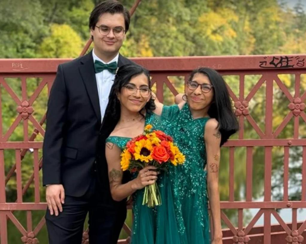 共用生殖系统的连体姐妹中的妹妹结婚了，妹妹同房时姐姐怎么办？
大家怎么看，一起评