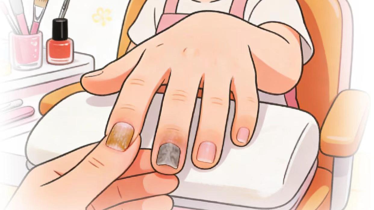 指甲问题很容易忽略，看看你和家人中招了吗？