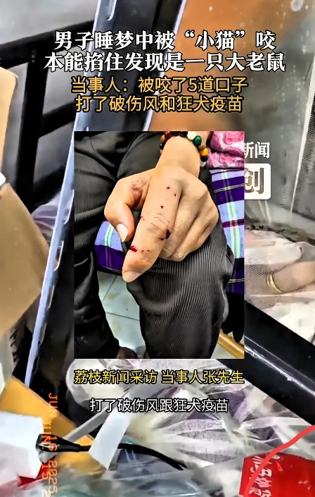“哎呀妈呀，太后怕了！”江苏无锡这事儿，可把人吓一跳。一男子睡梦中感觉手边毛绒绒