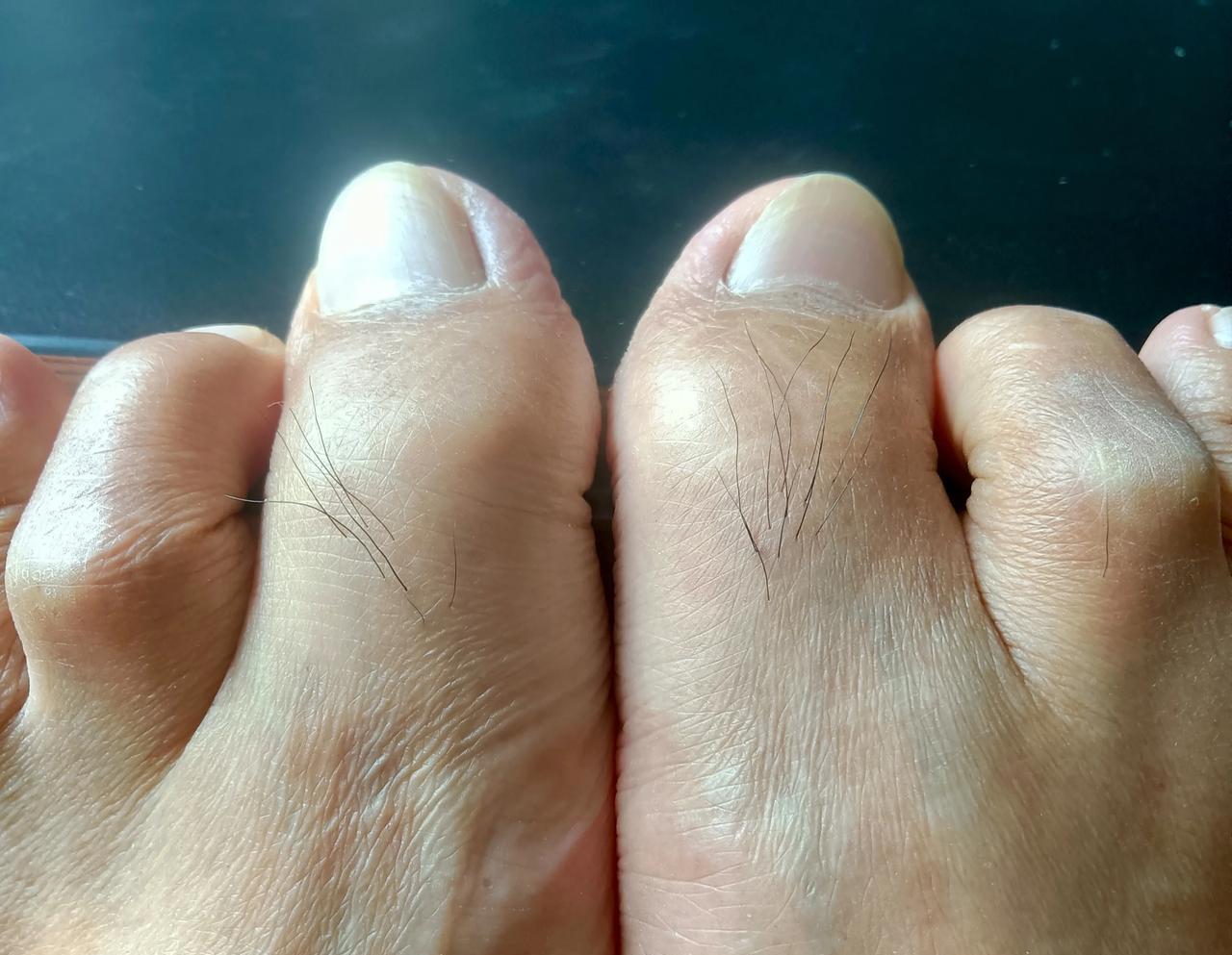 脚大拇指上长了一撮毛，在电脑上查了一下，说法如下：按照相学的解释，脚大拇指长毛一
