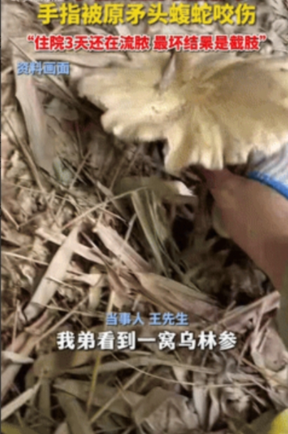 悲剧还是发生了！”四川自贡，一男子在山里掏蘑菇时，手刚伸进去就被原矛头蝮蛇咬伤，