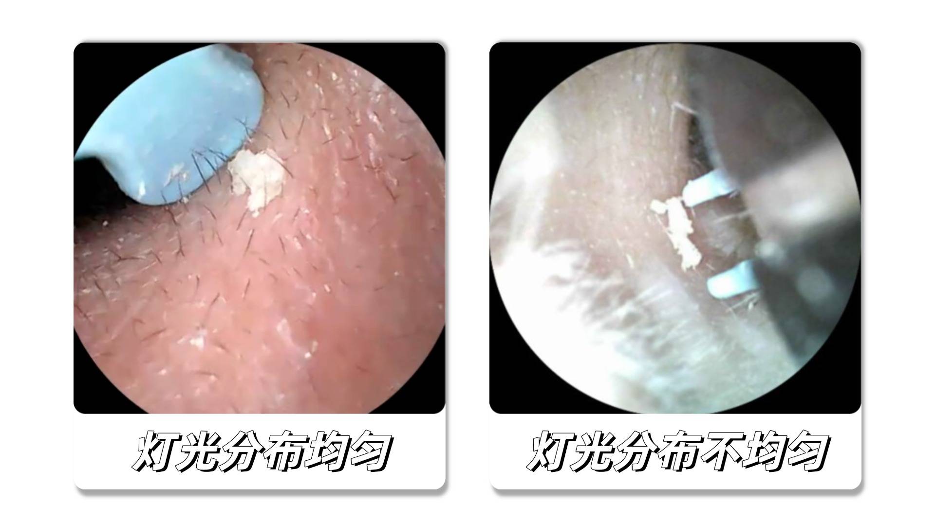 可视挖耳勺到底值不值得买？双十一可视挖耳勺哪家好？2025可视挖耳勺十大名牌排行榜出炉：买前建议收藏