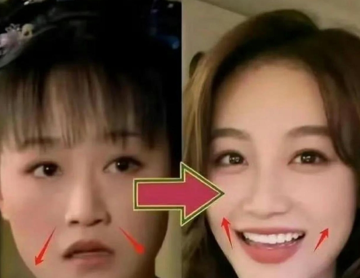 好神奇，蓝盈莹嘴形变化的秘密竟然是要筷子。

以前蓝盈莹的嘴型向下，整体面相偏苦