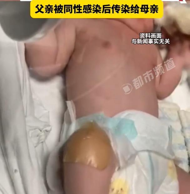 福建，一名16个月的新生儿，最近因为患上肺炎被妈妈带去医院治疗。经过检测得知，孩