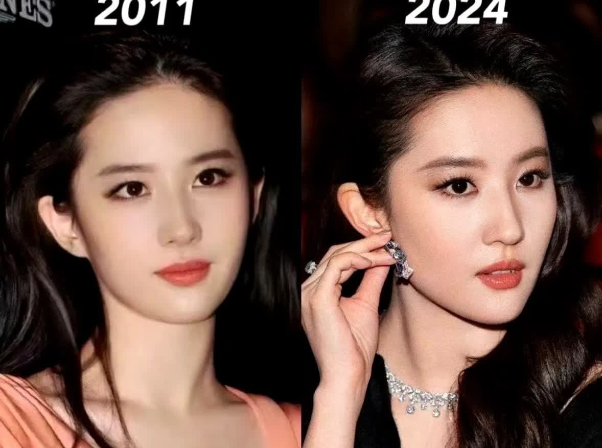 刘亦菲10年前是邻家妹妹，现在是高岭之花。10年前后变化，你觉得变化大吗？
刘