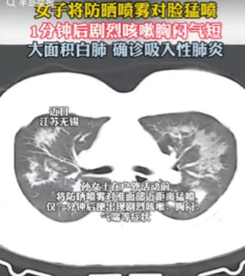 “江苏，女子为了防晒，竟然将防晒喷雾，对准全身喷了个遍，就连脸都没放过，结果，刚