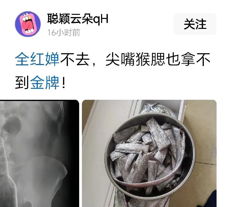 天呐，这种人就是故意黑全红婵的吧，太愚蠢了！
攻击人家小女孩外貌，但是全红婵也美