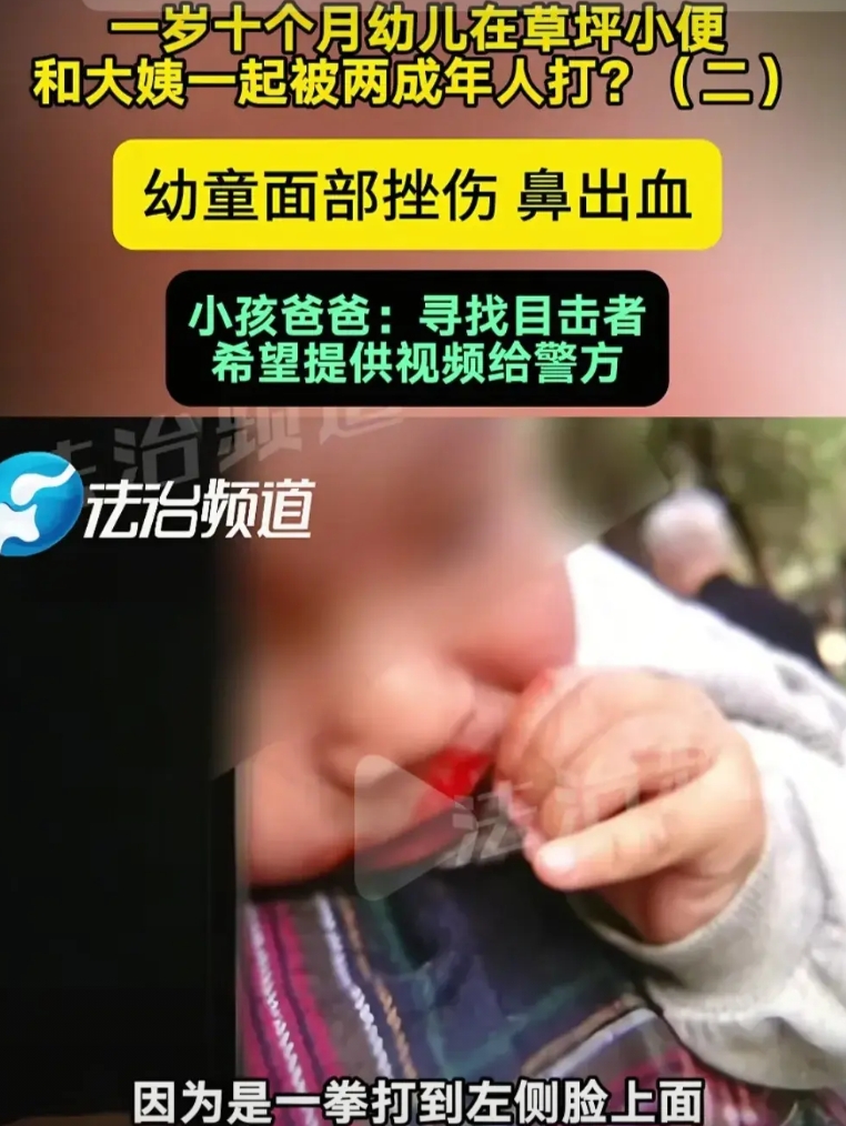 这是人干的事吗？一岁十个月的幼儿在草坪尿尿，和大姨一起被两名成年女子打伤，幼儿被