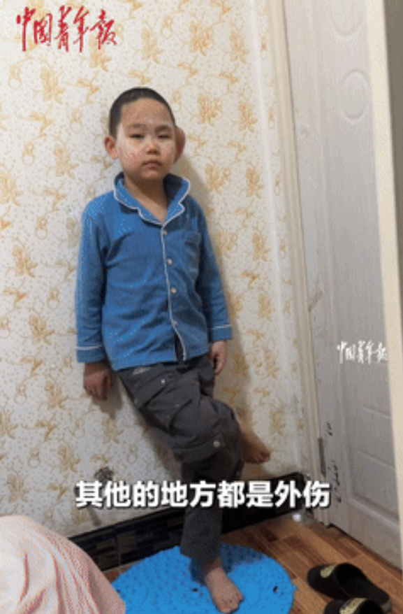 “中国青年报发声了！”7岁男孩被3只恶犬咬致重伤二级，治疗花20多万，狗主却只赔