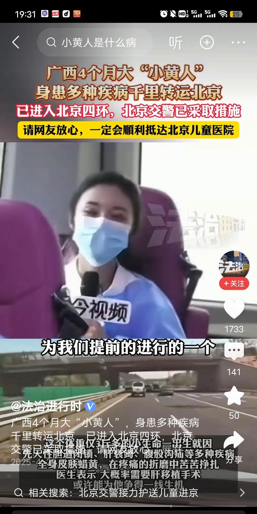 广西四个月大的小黄人，身患多种疾病。被多省联合转运这事，打了多少人的脸？
   