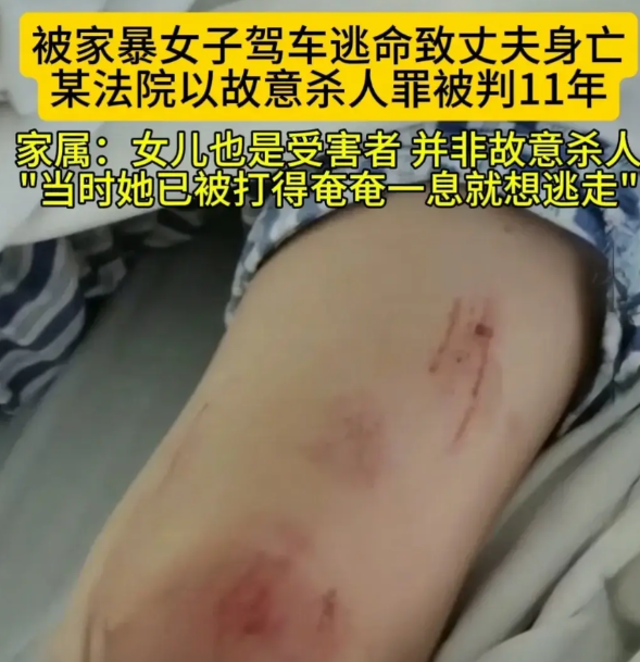 近日，石家庄一名女子在遭受家暴时，出于极度恐惧与求生本能，选择驾车逃离。然而，家