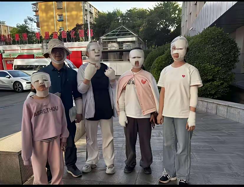 真是太倒霉了，朋友一家五一出去吃了个野餐一家人成了这样，卡式炉子用的时候还是要当