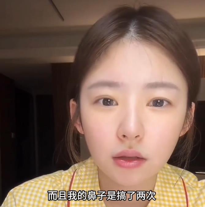 #黄一鸣自曝整容失败# “捞姐”成功上岸的黄一鸣直播自曝整容整鼻子失败了，嘴巴还