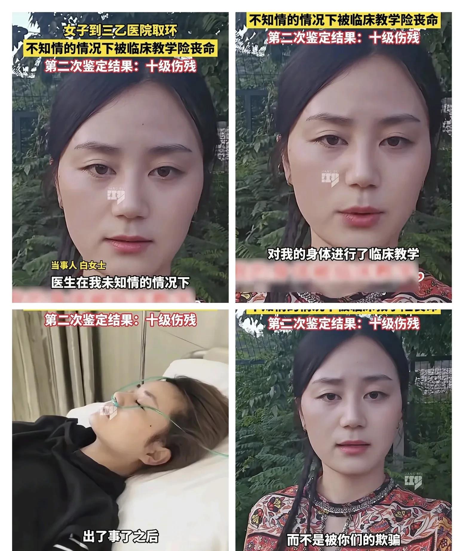 白女士在甘肃天水某三乙医院取环。

手术中疼痛难忍请求医生给止痛药遭拒，术后
