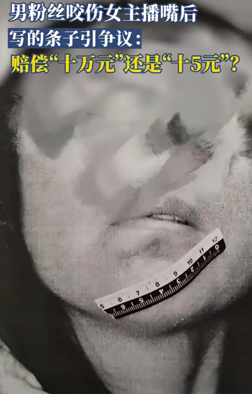 “大哥太狠了 ，这是多久没碰女人了”  竟能把女人的嘴咬烂，不但没占到便宜，还惹
