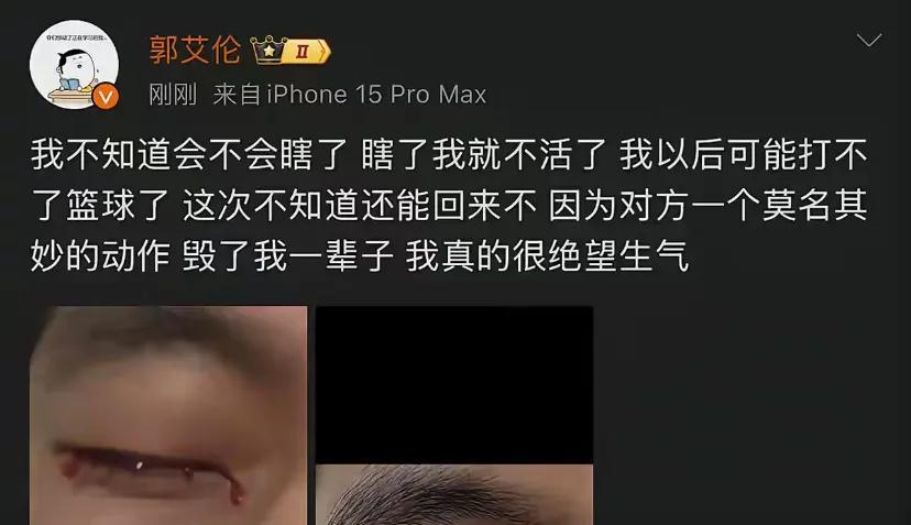 郭艾伦的眼睛受伤了，这对于大家来说是一个晴天霹雳，看到他受伤的眼睛，特别多的辽宁