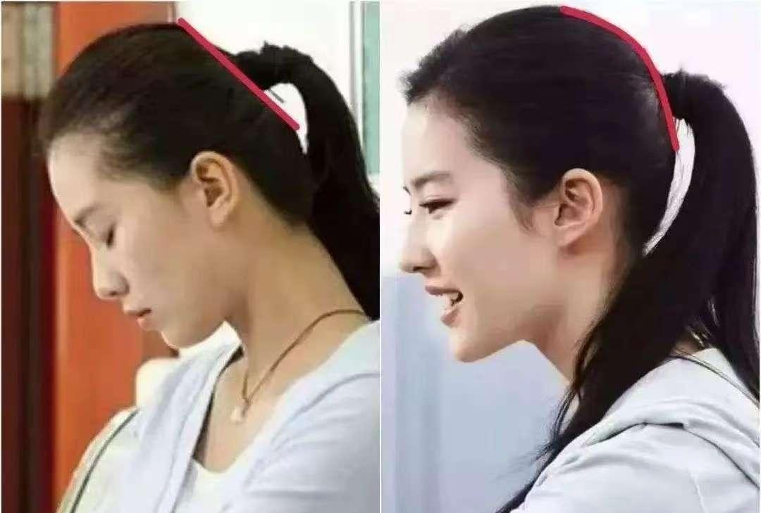 为什么刘亦菲比刘诗诗更漂亮
原因很简单
不是五官问题，也不是脸型问题，最大的问题
