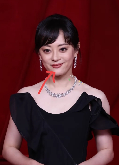 大家发现没有，
孙俪完全变了，
不是变好看，也不是变的会穿搭，而是她嘴下面的痣没