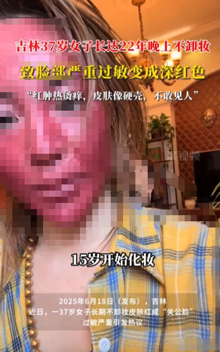 “简直就是美丽刑拘！”吉林，一37岁女子竟然22年都带妆睡觉，这也直接导致脸部严