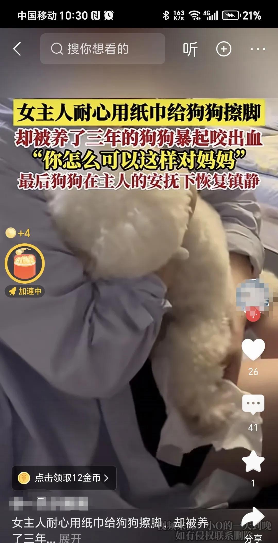 狗就是狗，谁知道啥时候兽性大发。
你以为给狗吃喝，给狗提供住的地方，悉心照料它就