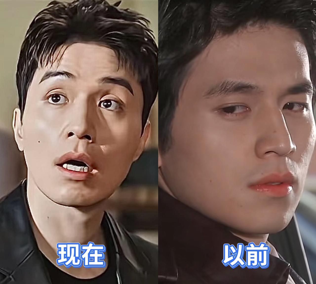 李栋旭现在
照镜子的时候
会想哭吧
原本被人称之为韩国初代男神的
一张脸，现在突