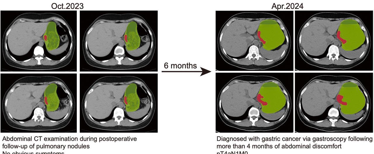 从一家美国企业的选择里，我看到了一个国际共识，时代真的变了。
以前的外国企业，依
