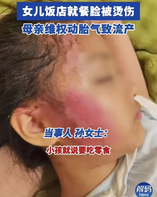 女子饭店就餐因女儿被烫伤欲跳楼，店家消极处理太离谱！