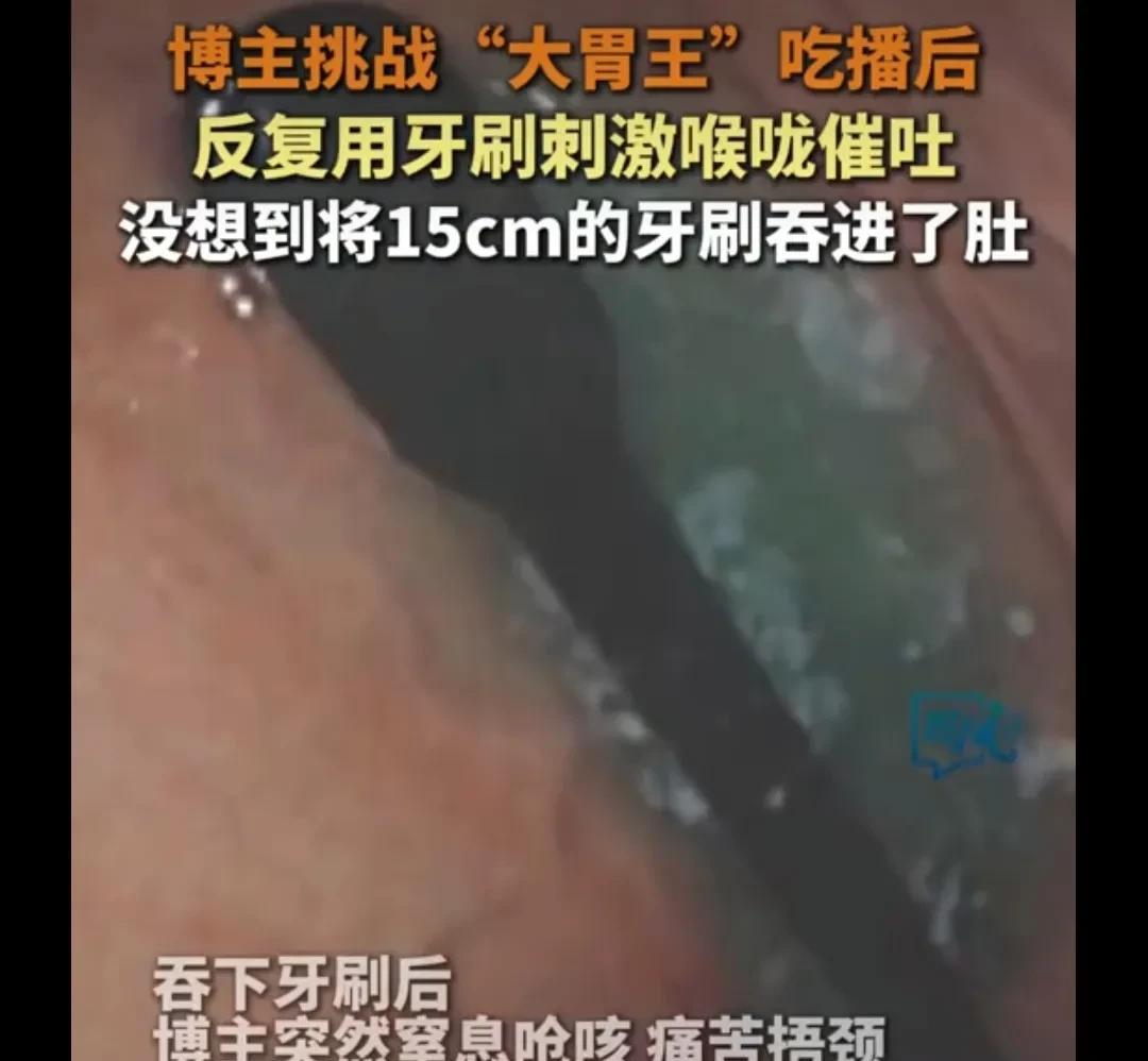 浙江，一网红吃播，为了在直播的时候，展现自己大胃王的本领，在很短的时间内，吃了太