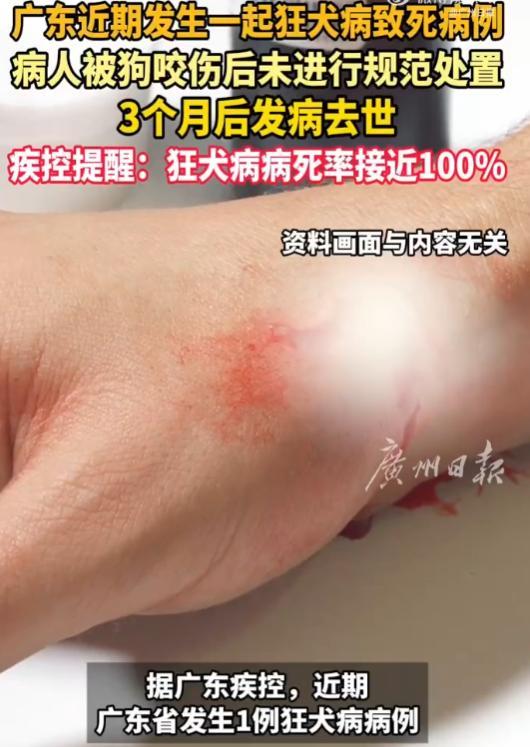 “太吓人了！”广东男子不慎被一未栓绳子的疯狗咬伤，男子觉得伤口不大，就懒得去医院