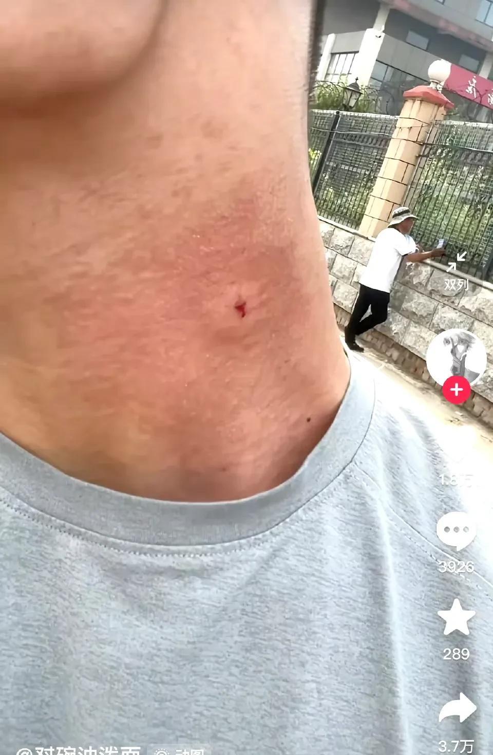 一学生，高考前40分钟被马蜂蛰了
这要是考不上大学，要全网寻找那只马蜂[捂脸]