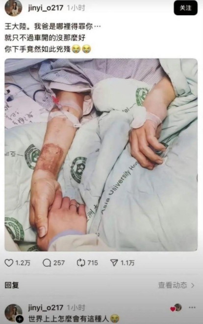 王大陆派人把人司机打成这样了…好严重！