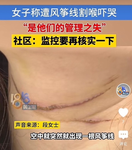浙江嘉兴，女子和丈夫骑电动车去买菜，在公园附近的一条路上被风筝线割喉，感到喉咙火