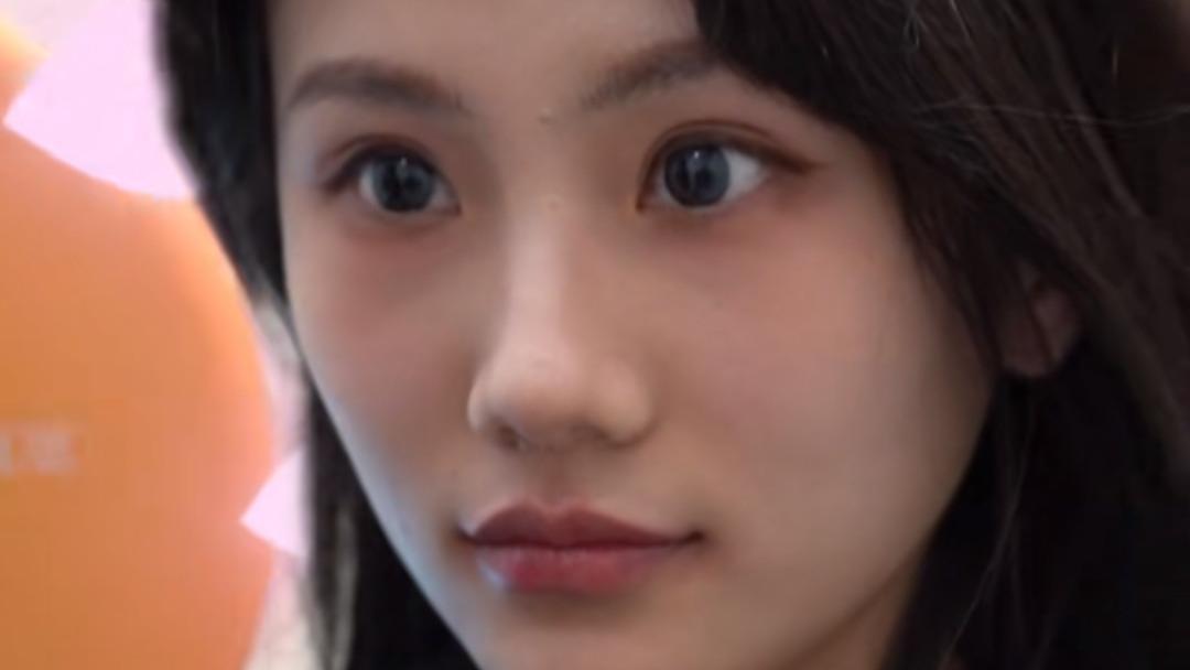 唇形不对称能调整吗？真人案例：秒变对称微笑唇！