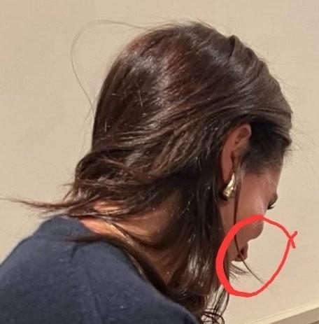 看看她那瘦长的、汗湿的、油腻的“头发”和毛衣上的大颗毛球，更不用说她脸颊上夸张的