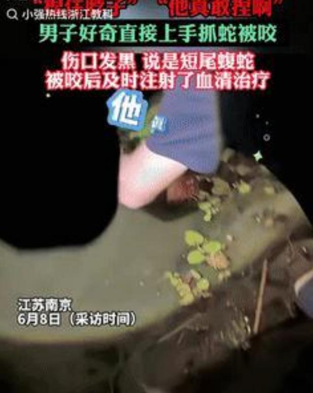 江苏南京一男子散步时抓蛇被咬，伤口发黑，后被告知是短尾蝮蛇。



6月8日，小