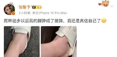 #张馨予雨林徒步脚肿成猪蹄# 张馨予在西双版纳每天暴走的结果就是脚肿成猪蹄吗看得
