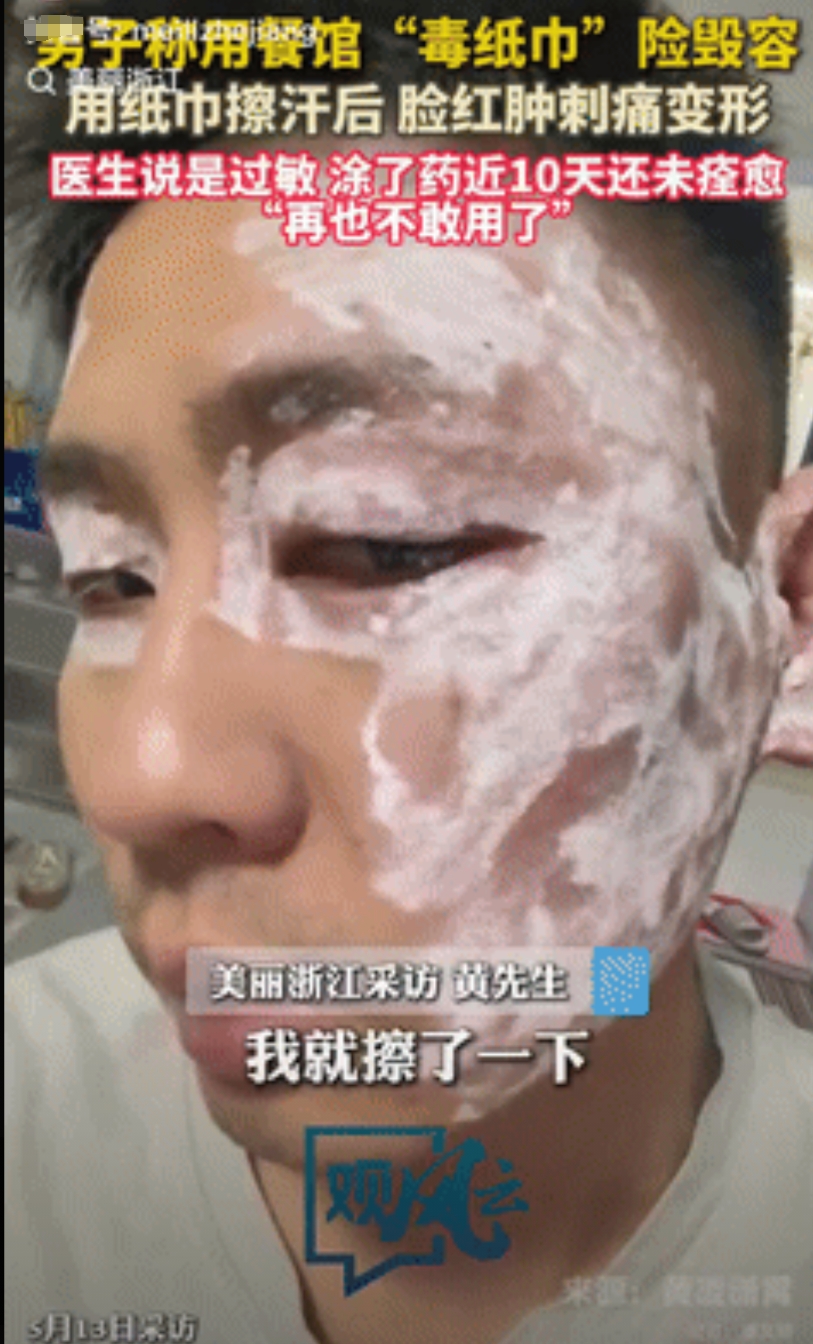 太吓人了！安徽，小伙去小饭馆吃麻辣烫，因为出了一些汗，就用店里的纸巾纸擦了脸，不