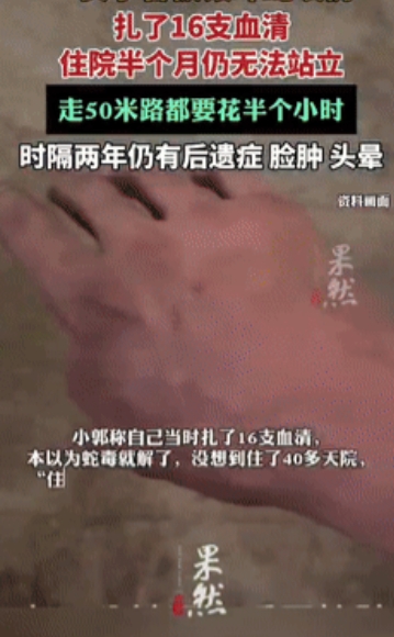 “命真大！”近日爆出，一女子和丈夫在两年前去云南普洱旅游时，在酒店的床上不幸被银