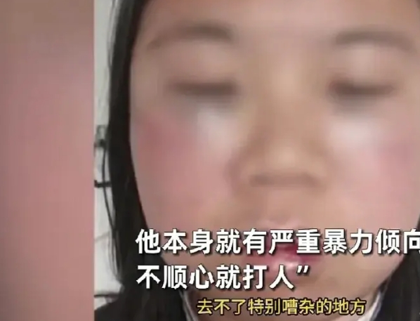 唉呀妈呀，这女儿都被打成猪头了，摊上这样的赌鬼父亲也真是可怜！女子因揭露父亲炒股
