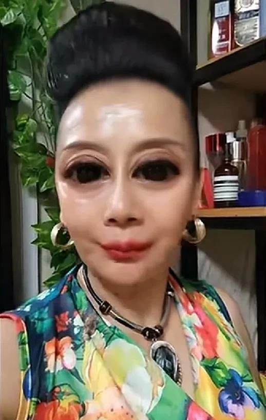 这女子的双眼皮是后天做的。
一共花了20000元。效果就这样。
你认为值不值？我