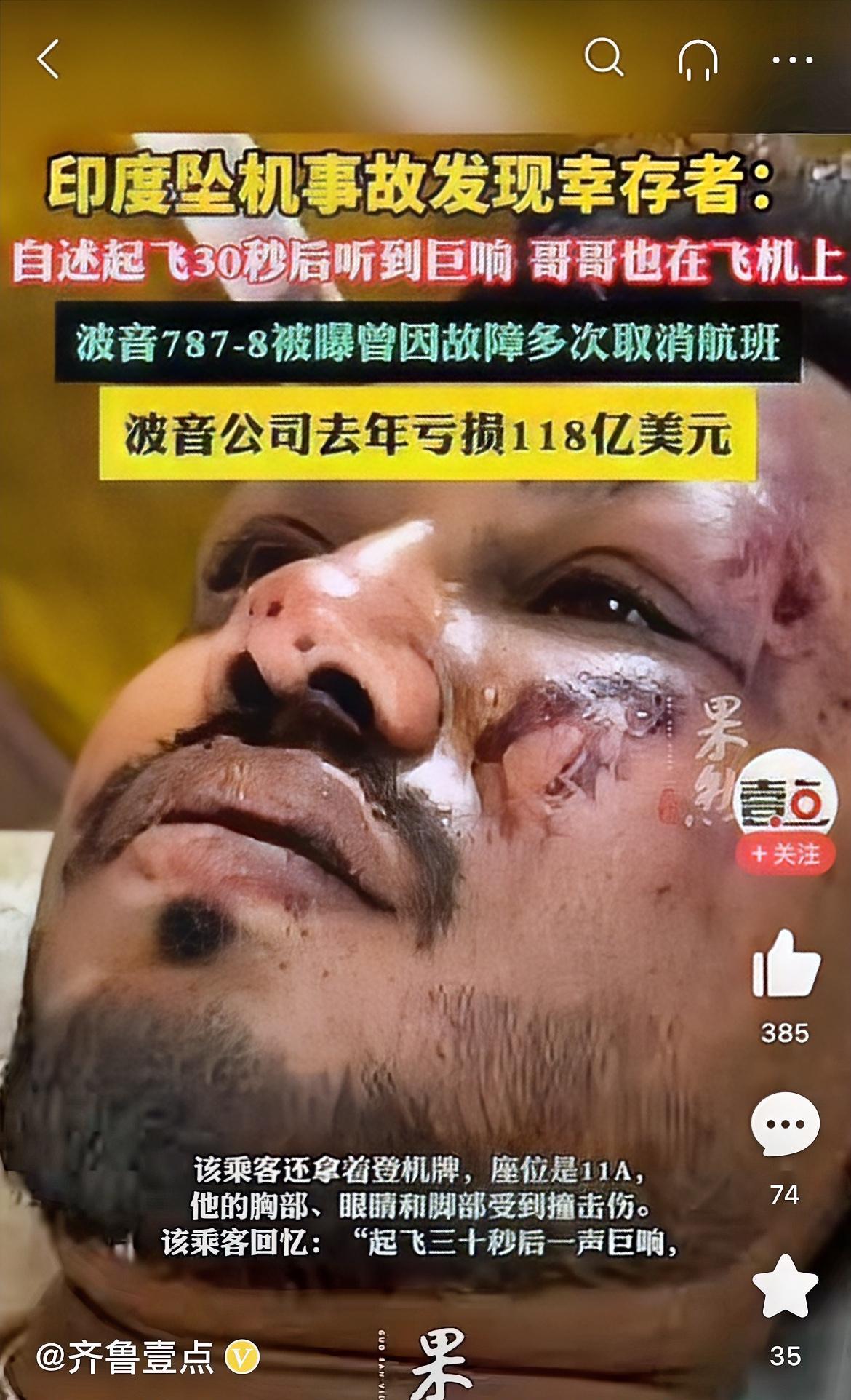 由衷表示，这位老兄命是真硬。
印度空难今早传来奇迹，一片死寂中出现了一名幸存者，