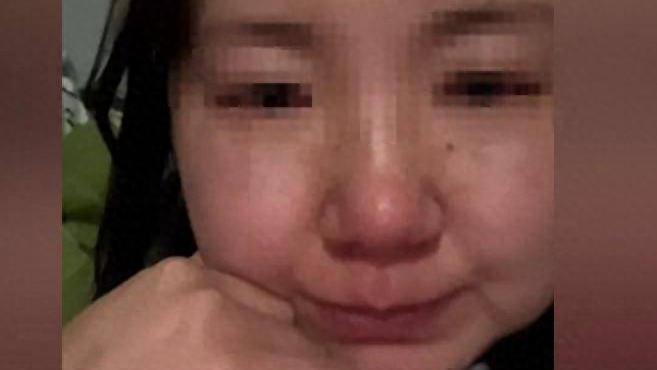 34岁女子拔牙后坠亡：一场本可避免的医疗悲剧？