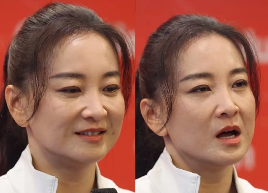 瘦了的贾玲面相变精明了！8月2日，43岁的贾玲现身某运动品牌活动，明显状态比去年