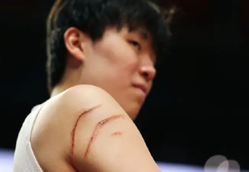 杨瀚森被挠了2个血印子！

对阵火箭的比赛，杨瀚森出战了16分31秒，拿下3分3