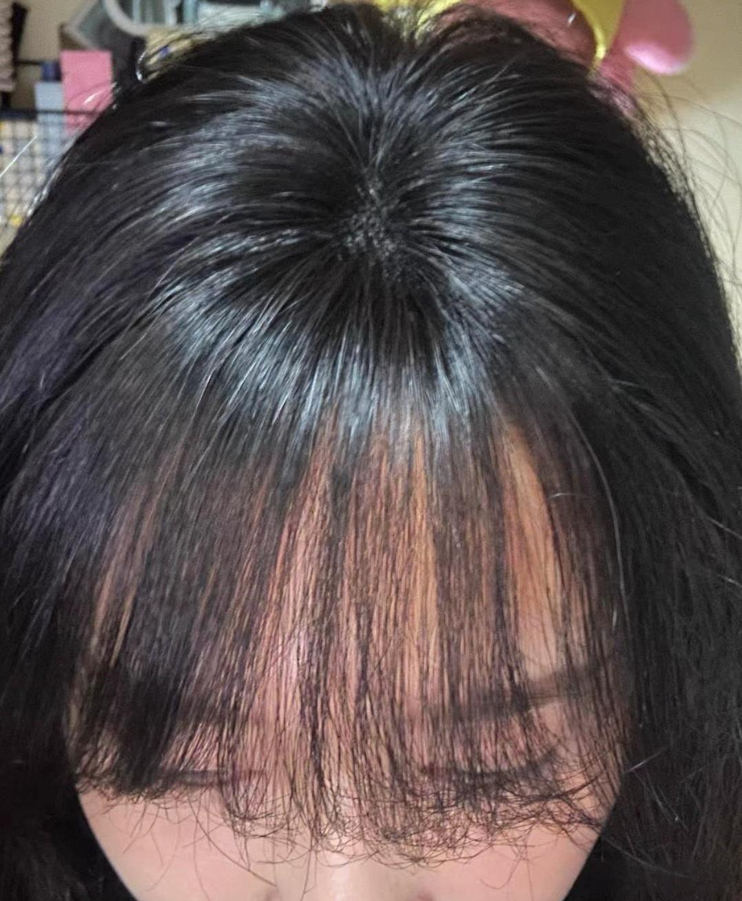 发现了吗？
但凡显年轻的人都有一头浓密乌黑的头发。放眼望去，现在很少有人到了中年
